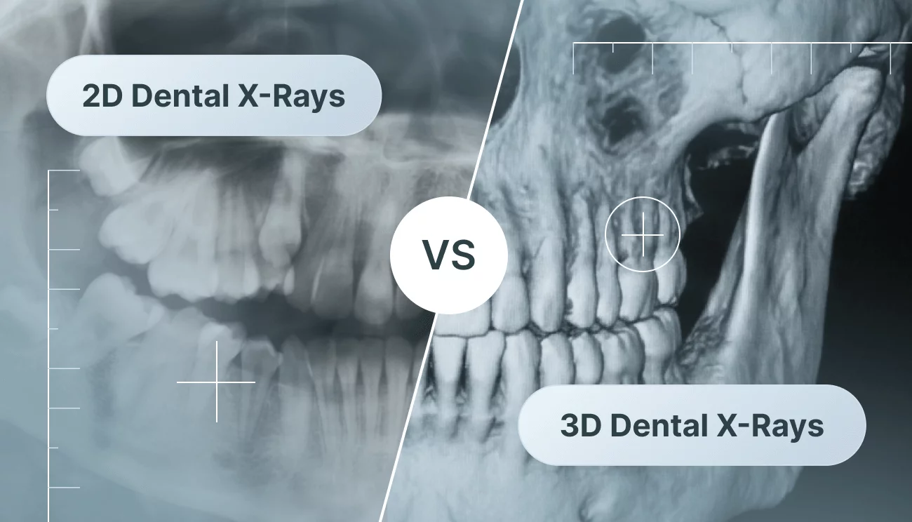 Side-by-side comparison of traditional 2D dental x-rays and 3D CBCT imaging